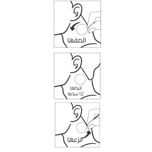 لاصقات توضع علي علي العنق لمنع تساقط الشعر وتحفيز نمو الشعر